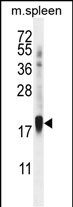 ZNF593