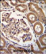 Rabbit Polyclonal Antibody to ENPEP