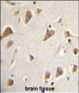 Rabbit Polyclonal Antibody to ZMYND10