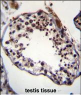 Rabbit Polyclonal Antibody to TRIM69  (N-term)