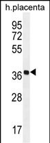 OR5AS1