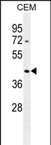 ACTBL3 (N-term)