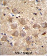 Rabbit Polyclonal Antibody to PCDHAC2