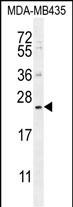 FAM109A (N-term)