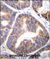 Rabbit Polyclonal Antibody to FAM109A (N-term)