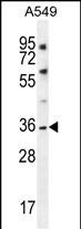 KCNK1