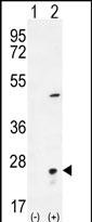 VSNL1