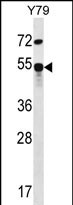 ZFP14 (N-term)
