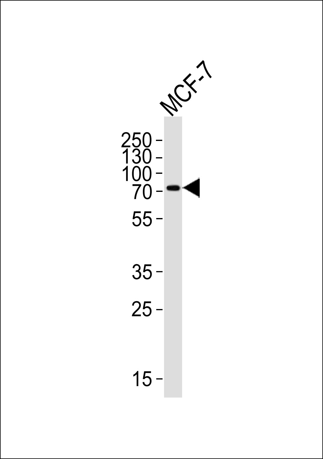 KLC2 (N-term)