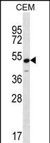 KCNJ8 (N-term)