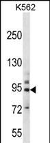 PCDHB14 (N-term)
