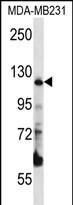 PITRM1
