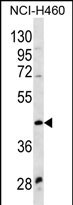 WNT9A
