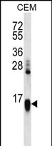 HIST1H2AA (N-term)