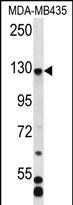 C7orf63 (N-term)