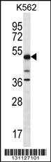 PSTPIP1 (N-term)