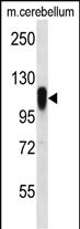 FBX41 (N-term)