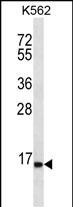 SPINK8