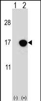 CDKN2B