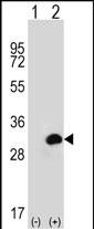 CA1 (N-term)