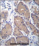 Rabbit Polyclonal Antibody to CA1 (N-term)