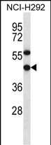 EBNA1BP2