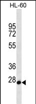 MED22 (N-term)