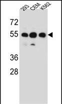 ZNF562 (N-term)