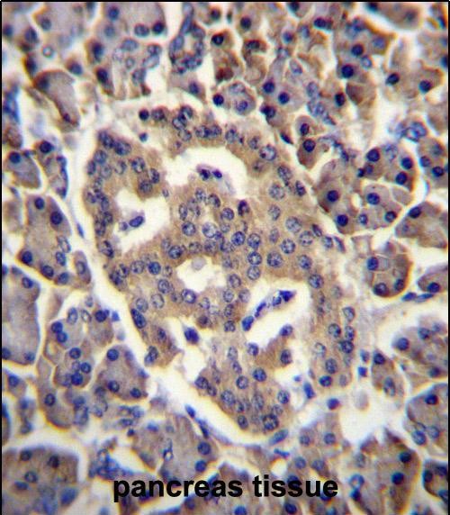 Rabbit Polyclonal Antibody to SPNS3