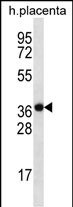 SLC38A8