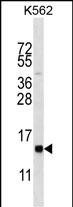 HIST1H2BL (N-term)
