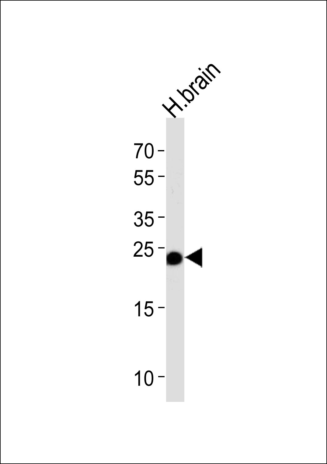 GSTM5 (N-term)