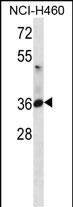 ATP1B3
