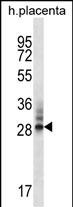 DNAJC27 (N-term)