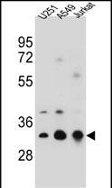 TPM4 (N-term)