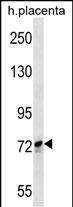 SCYL1 (N-term)