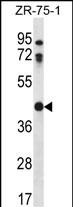 CTSO (N-term)