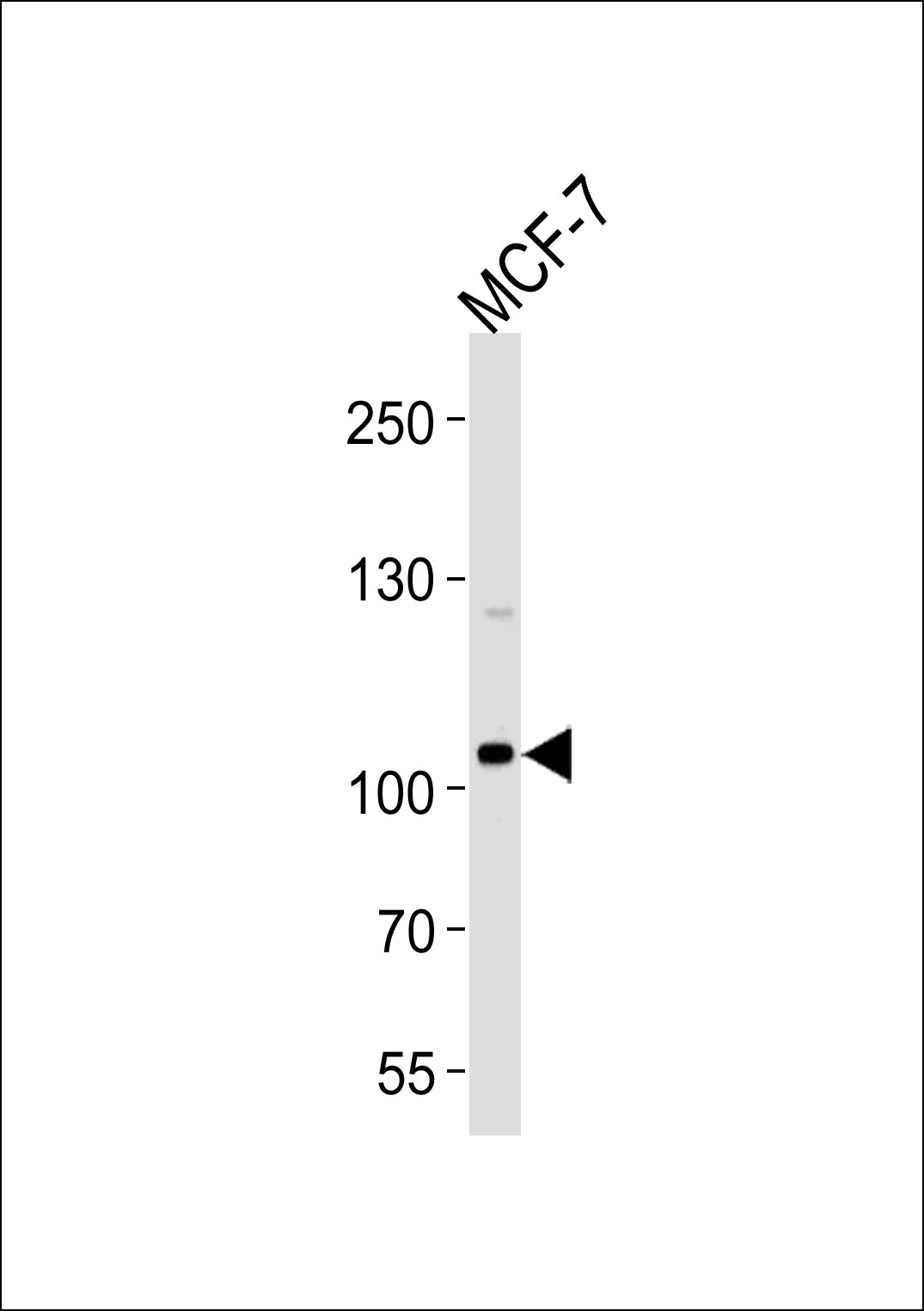 SULF2
