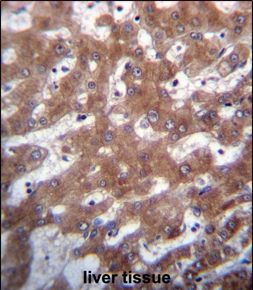 Rabbit Polyclonal Antibody to TRUB1