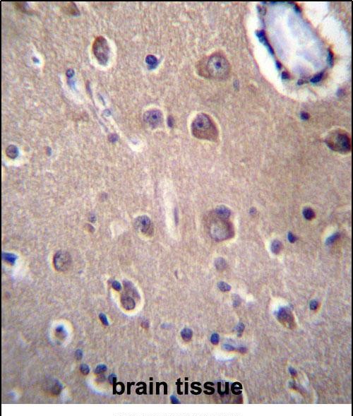 Rabbit Polyclonal Antibody to SLC8A3