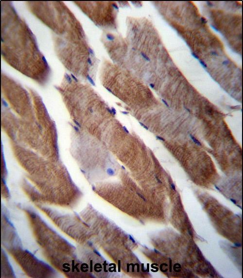 Rabbit Polyclonal Antibody to MATN1