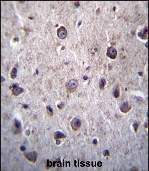 Rabbit Polyclonal Antibody to DOC2A