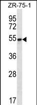 SEC62 (N-term)
