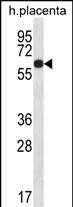 GLCCI1