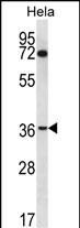 NUP35