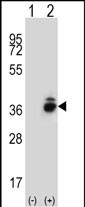 CRHBP (N-term)
