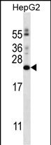 PIGH (N-term)