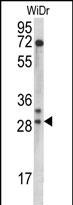 MRPL9 (N-term)