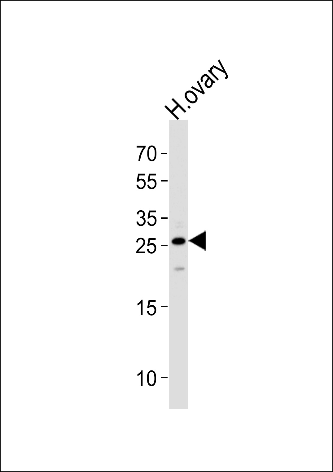 CCDC90B