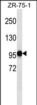 PHF14 (N-term)